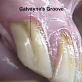 Galvayne's Groove