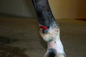 after Shock Wave Therapy
