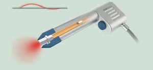 shockwave handpiece 2